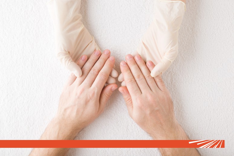 Infecțiile fungice (Micoze): o problemă comună a pielii și unghiilor