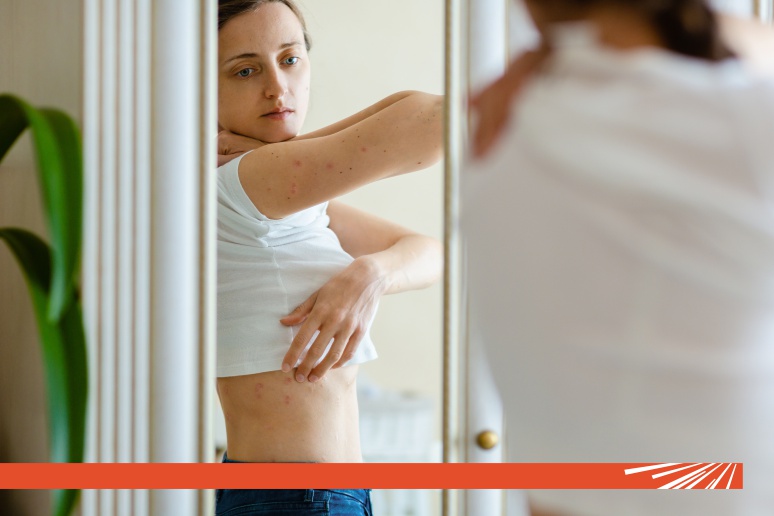 Tratament psoriazis: ce opțiuni există?