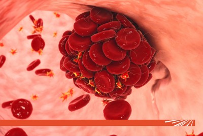 Care sunt cele mai des întâlnite boli de sânge?