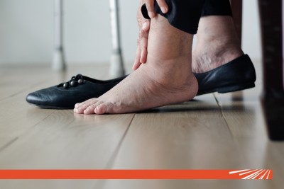 Picioarele umflate: inimă, vene sau rinichi?