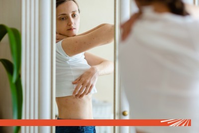 Tratament psoriazis: ce opțiuni există?